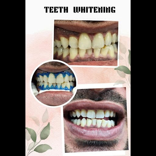 Dr. Pallavi Pawar dentist