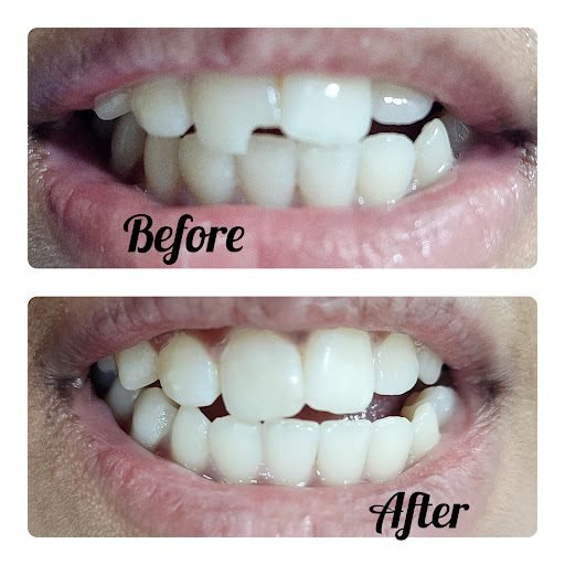 top rated dentist near me Thane