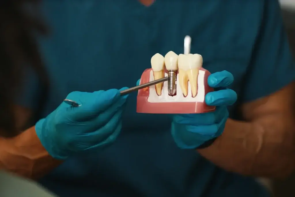 Dental implants treatment for missing teeth