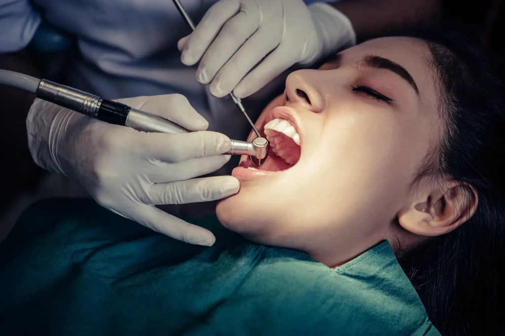 Re-root canal treatment in Thane West