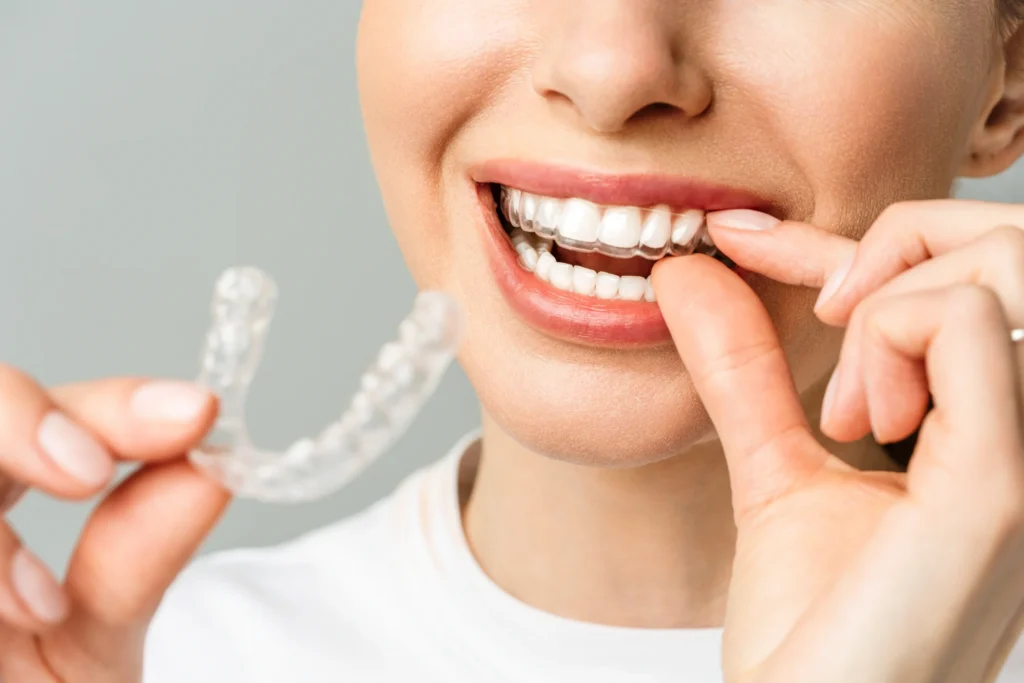 Close-up of a smiling woman holding custom clear aligners, highlighting the benefits of invisible aligners at Dr. Pawar's Advanced Dentistry in Thane West.