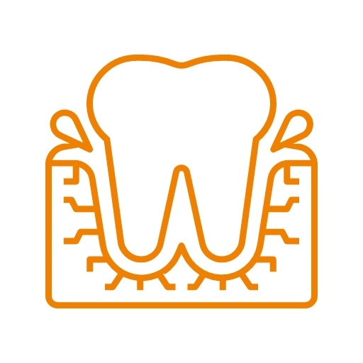 Bleeding Gums Treatment - Dr. Pawar's Advanced Dentistry Clinic