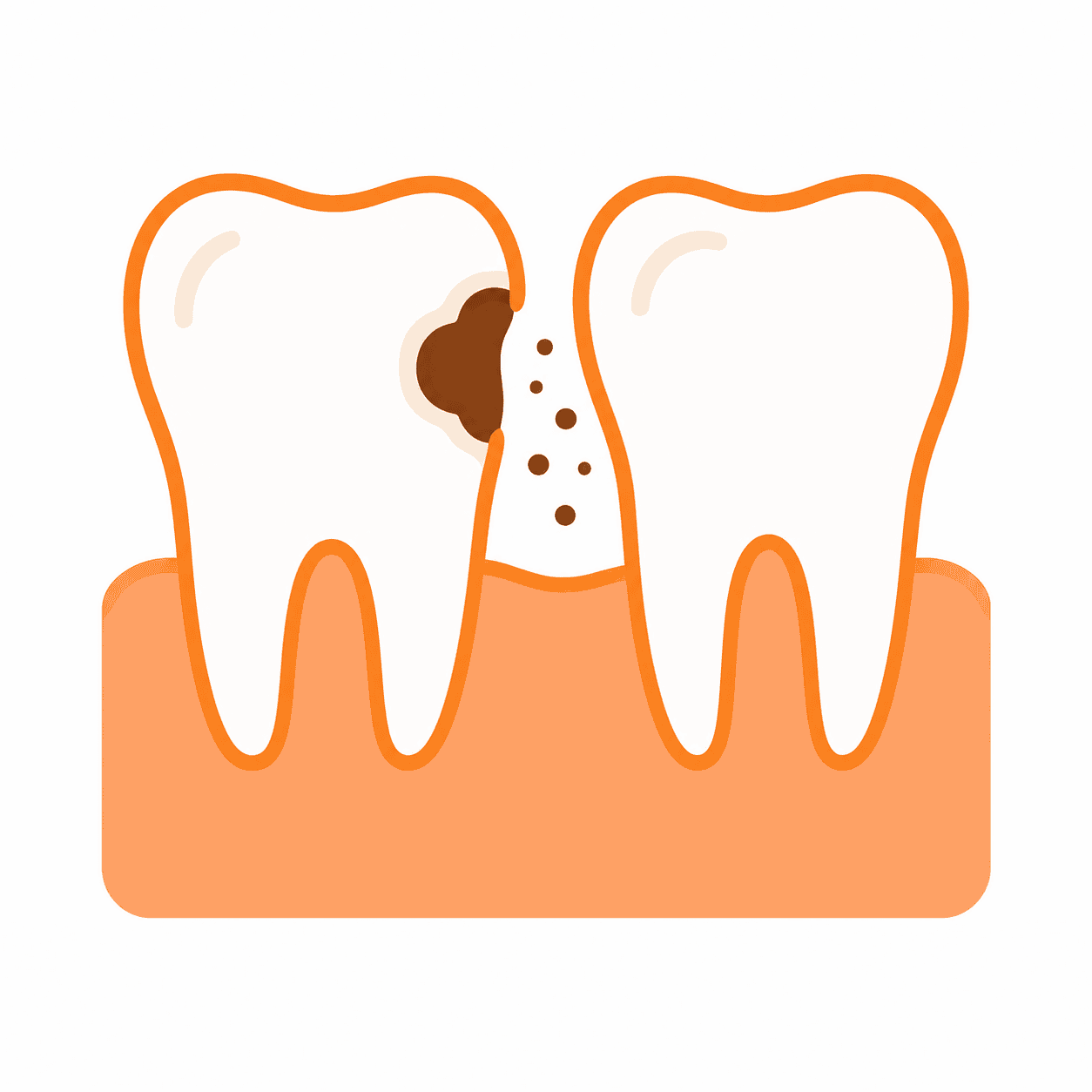 Decay risk to adjacent tooth treatment at Dr. Pawar's Advanced Dentistry in Thane