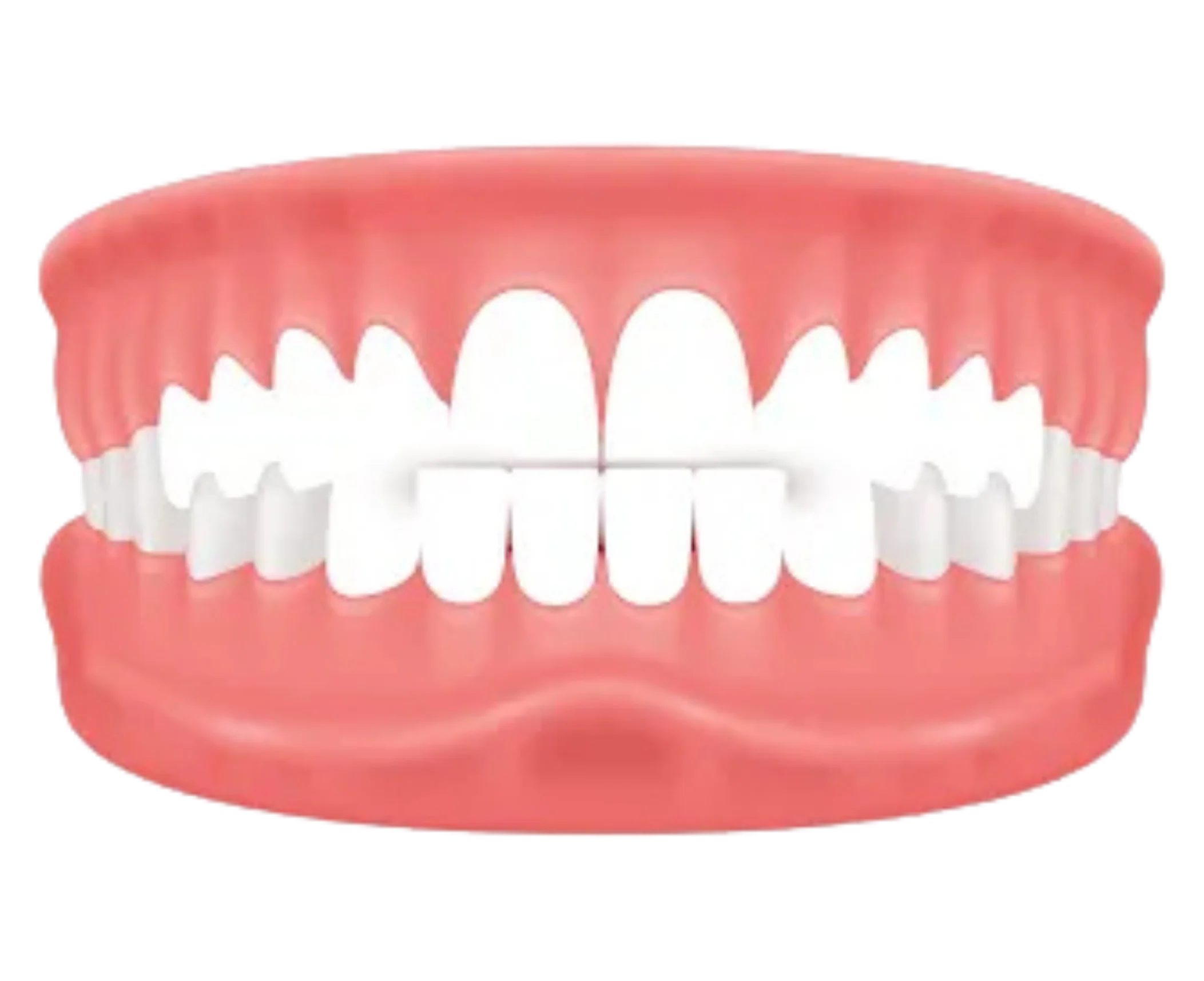 Illustration of an edge-to-edge bite where upper and lower teeth meet directly, an orthodontic condition treatable with custom invisible aligners at Dr. Pawar's Advanced Dentistry in Thane West.