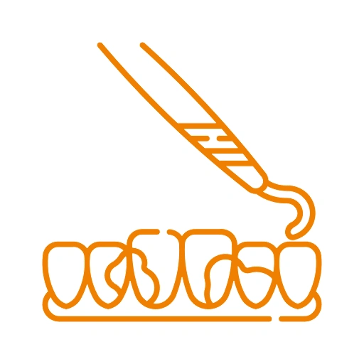 Scaling and Root Planing Treatment - Dr. Pawar's Advanced Dentistry Clinic