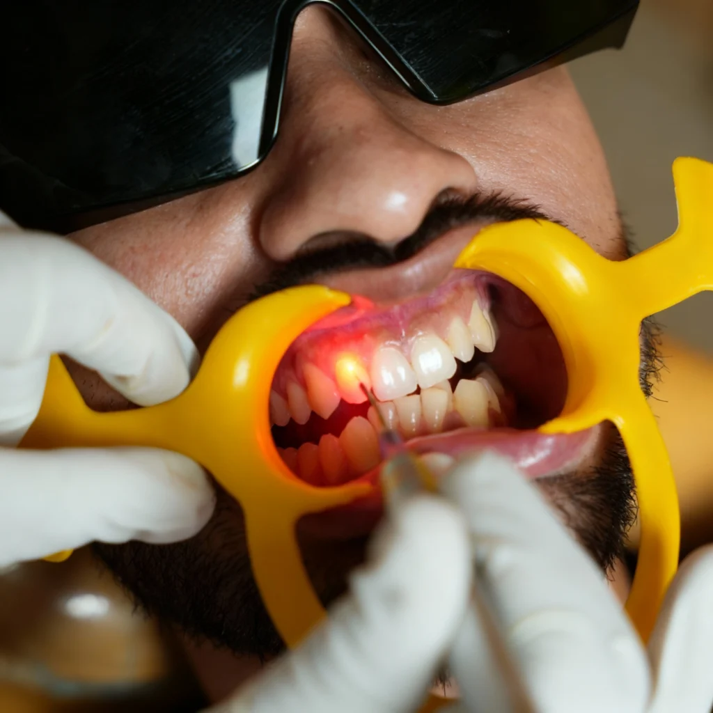Educational illustration showing the benefits of gum disease therapy - Dr. Pawar's Advanced Dentistry Clinic