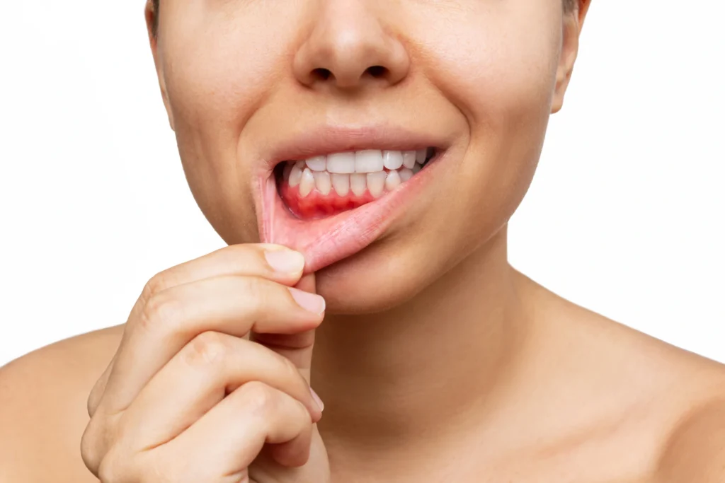 Gum Surgery Treatment - Dr. Pawar's Advanced Dentistry Clinic
