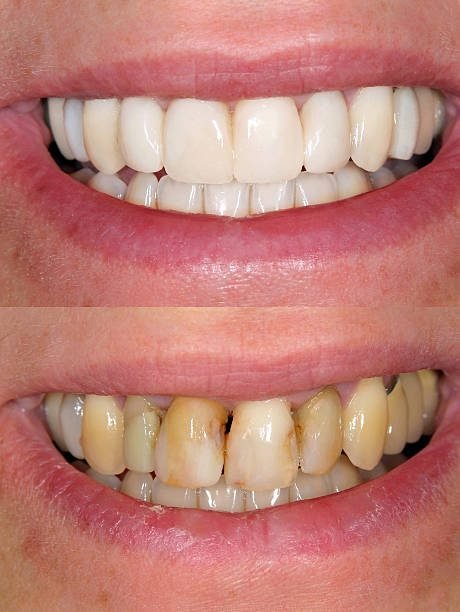 Dental Case 8
