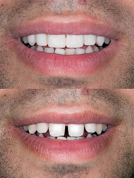 Dental Case 4