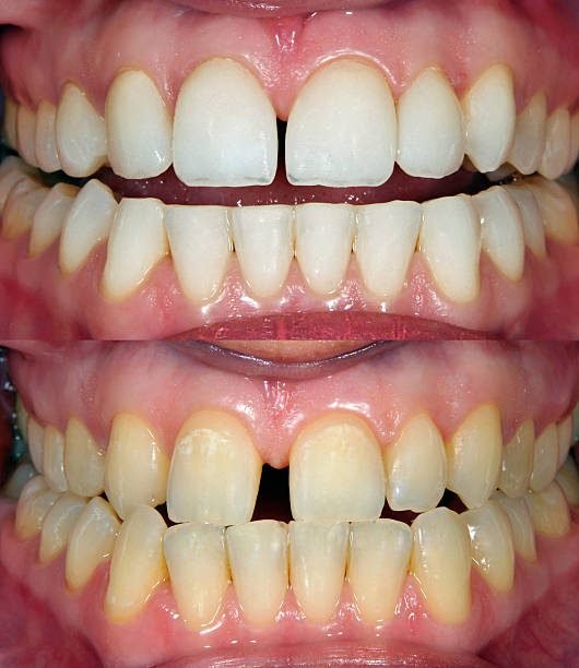 Dental Case 5