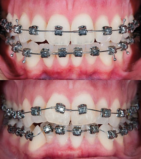 Dental Case 3