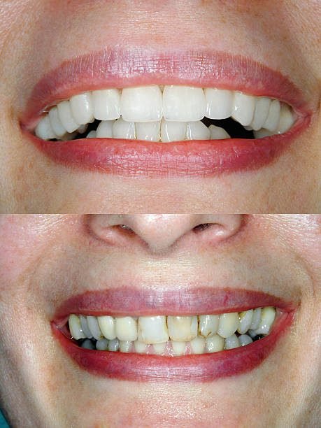 Dental Case 6