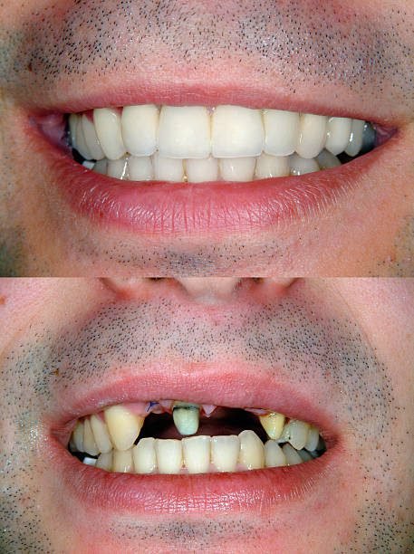 Dental Case 2