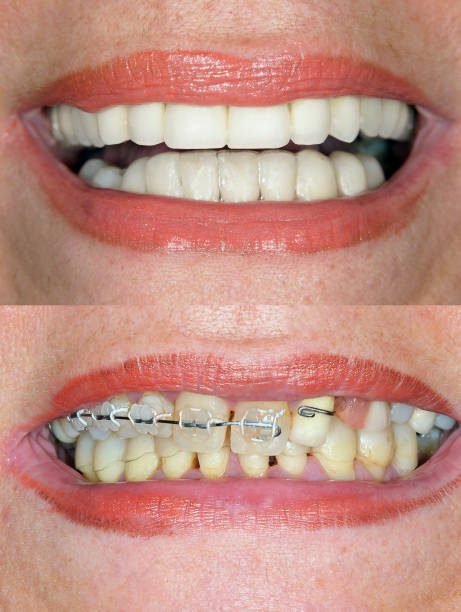 Dental Case 7
