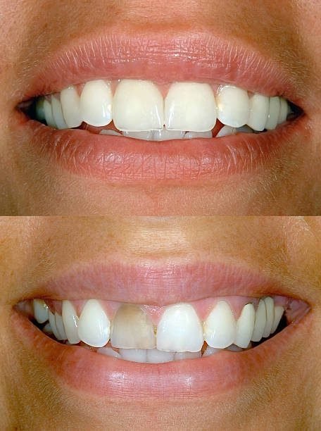 Dental Case 1