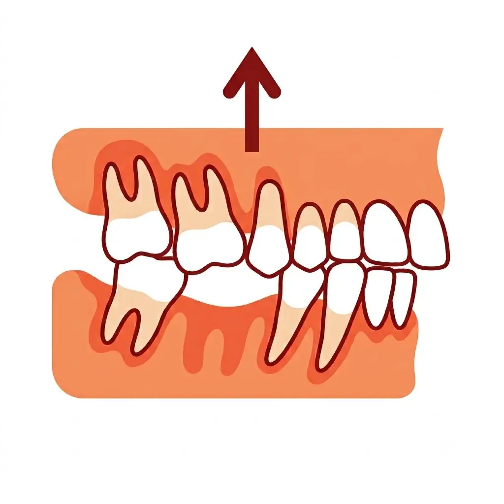 Illustration showing bite alignment issues and jaw changes caused by missing or damaged teeth at Dr. Pawar's Advanced Dentistry in Thane West.
