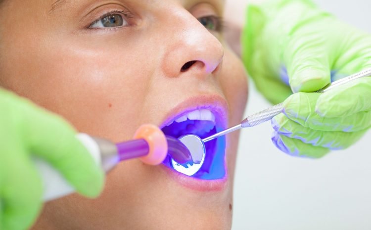Dentist performing a tooth-colored dental filling procedure on a patient in Thane West