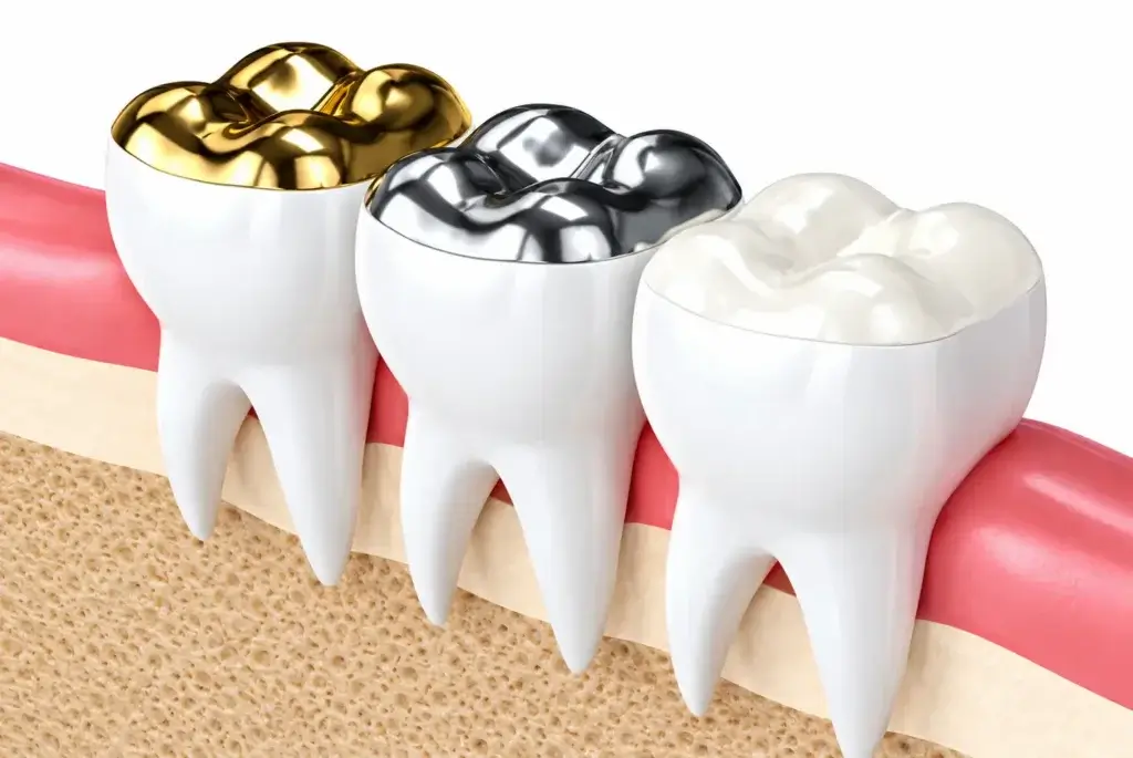 Tooth jewellery treatment at Dr Pawar Dental Clinic