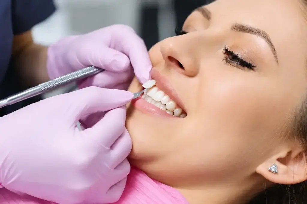 Dental Veneers Treatment in Thane West | Dr. Pawar's Advanced Dentistry