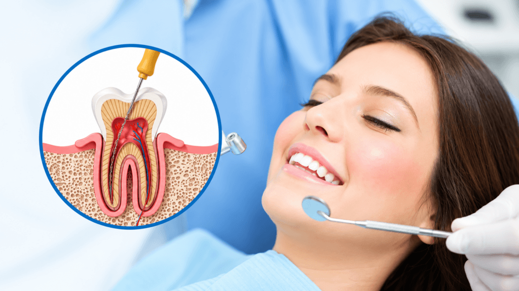 Single-visit root canal treatment in Thane West, Maharashtra, at Dr. Pawar's Advanced Dentistry, designed to treat infected or damaged teeth efficiently with modern dental techniques.