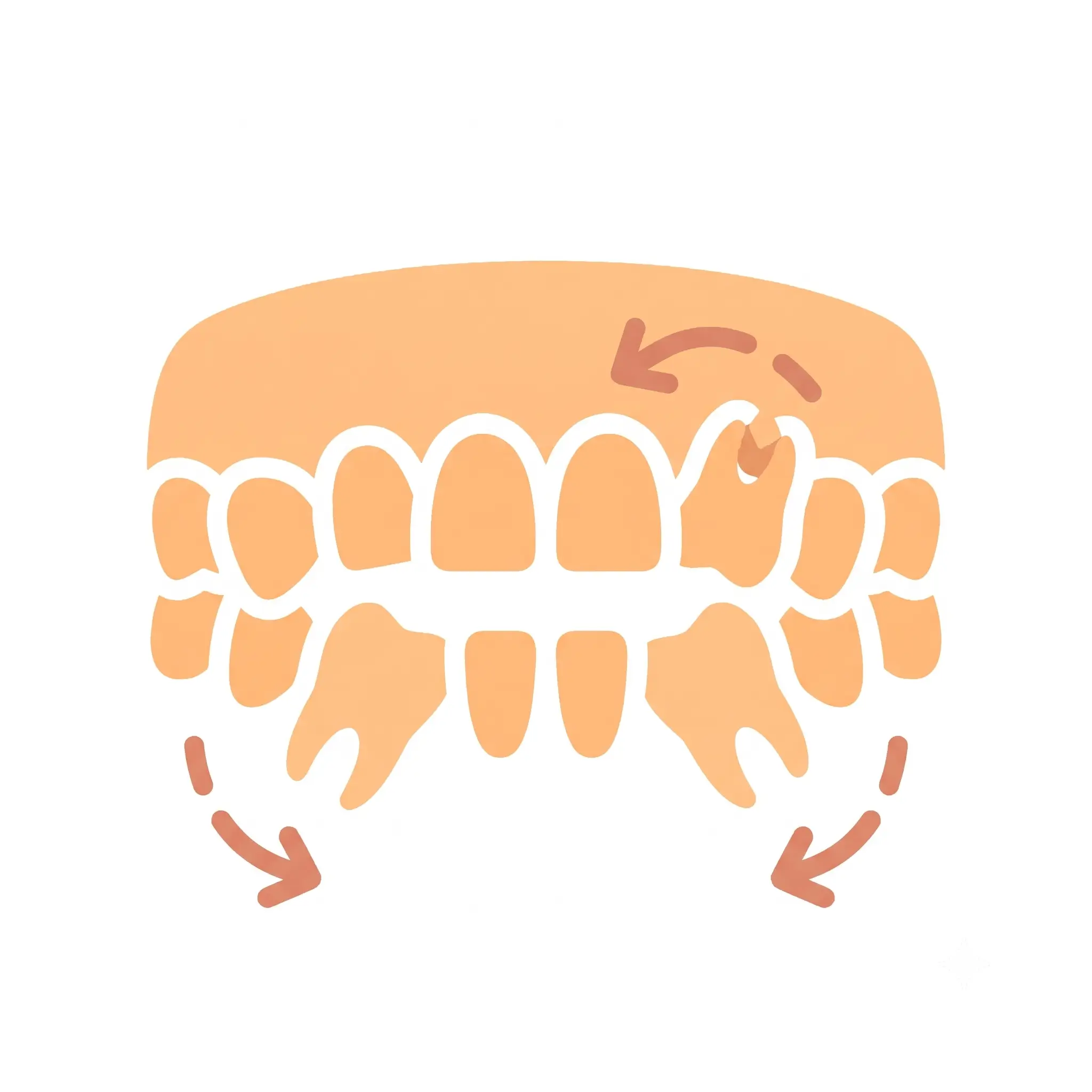 Illustration showing adjacent teeth shifting into gap caused by missing tooth - Dr. Pawar's Advanced Dentistry Thane West
