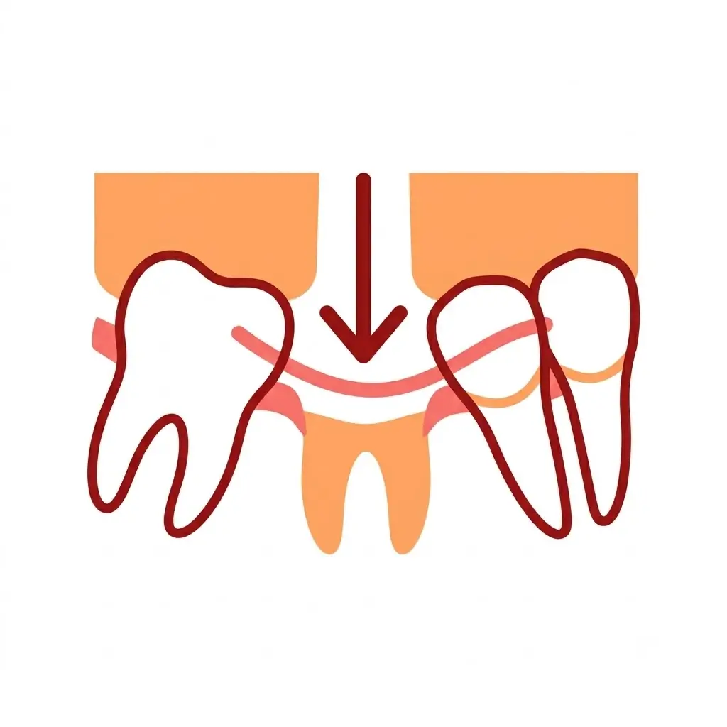 Illustration showing adjacent teeth shifting into the gap of a missing tooth at Dr. Pawar's Advanced Dentistry in Thane West.