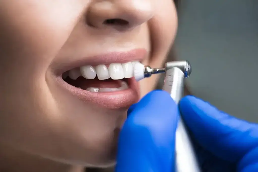 performing teeth cleaning and polishing procedure on a patient in Thane West.