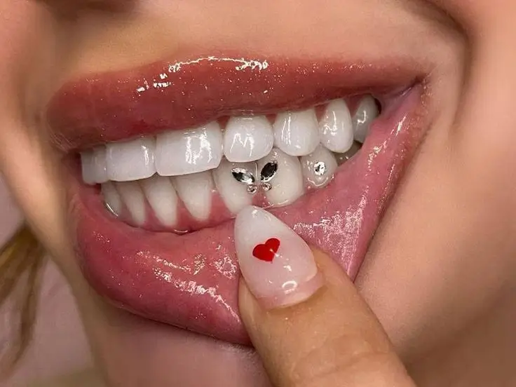 Close-up of a sparkling tooth gem attached to an upper tooth.