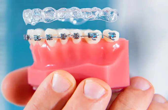 Comparison demonstration model showing clear invisible aligners vs traditional metal braces at Dr. Pawar's Advanced Dentistry in Thane West.
