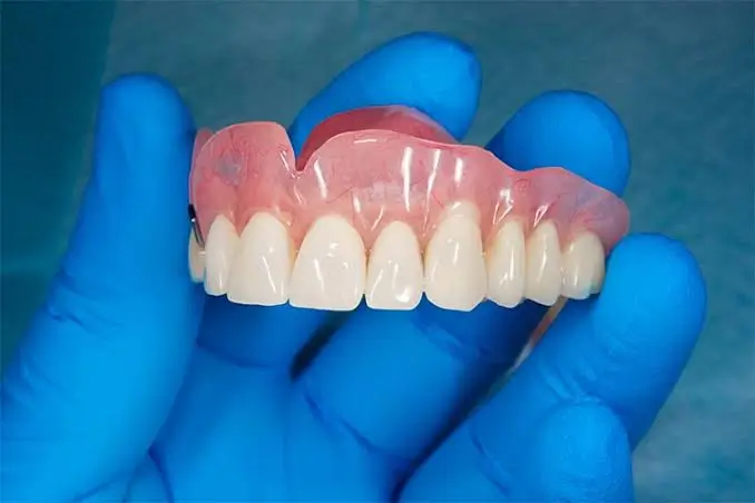 Full set of upper and lower dentures provided by Dr. Pawar's Advanced Dentistry in Thane West