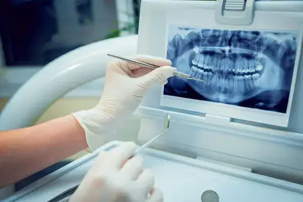 Digital dental X-ray imaging equipment for patient examination