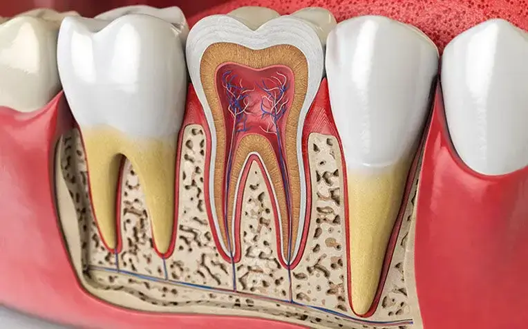 Dentist in Thane West Re-root canal treatment procedure performed by an endodontist in Thane West