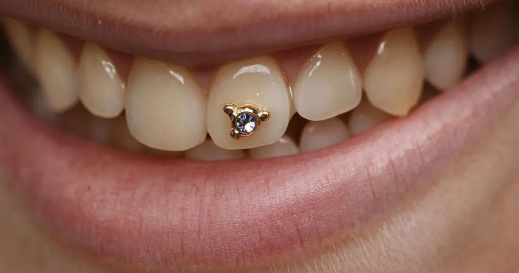 Close-up of a sparkling tooth gem attached to an upper tooth.